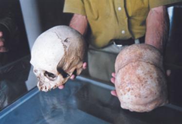 Elongated skulls from Malta